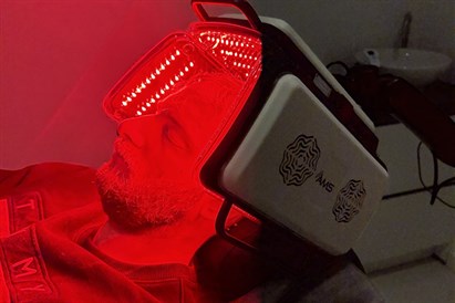 Fotobiostimuliacija: 12 procedūrų kursas