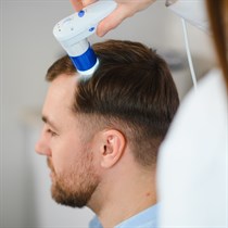 Mezoterapija plaukams „MOA Beauty“