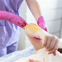 Plaukelių šalinimas cukraus pasta