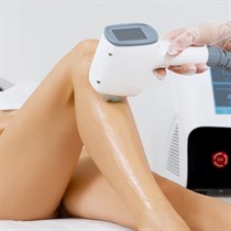 Plaukelių šalinimas diodiniu lazeriu