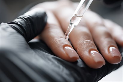 Nagų priauginimas Kaune