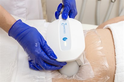 Pasirinktos kūno srities krioterapija