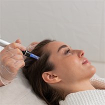 PRP terapija plaukams