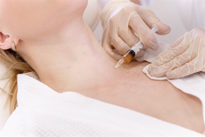 Jauninamosios PRP injekcijos