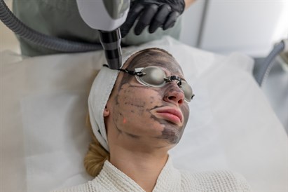 Veido šveitimas CARBON PEEL