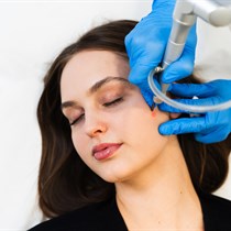 Veido procedūra su lazeriu „MultiTherapy“