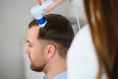 Mezoterapija plaukams „MOA Beauty“