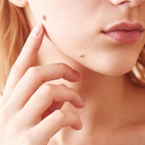 Apgamo tyrimas ir šalinimas + konsultacija