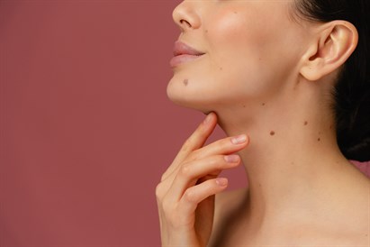 Apgamo tyrimas ir šalinimas + konsultacija