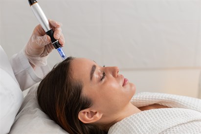 Mezoterapija plaukams „Perfectus Clinica“