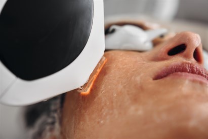 Jauninamoji veido procedūra IPL