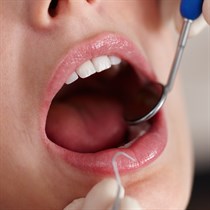 Profesionali burnos higiena Klaipėdoje