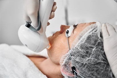 Jauninamoji veido procedūra IPL