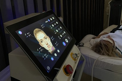 Veido stangrinimo procedūra su EMS ir RF