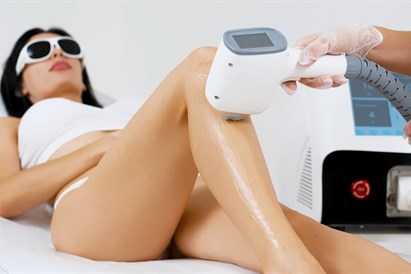 Plaukelių šalinimas diodiniu lazeriu