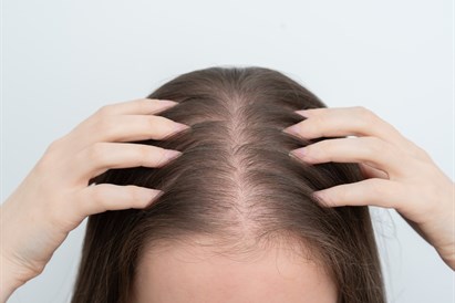 Mezoterapija plaukams „MOA Beauty“