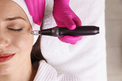 Regeneracinė egzosomų terapija su „Dermapen“