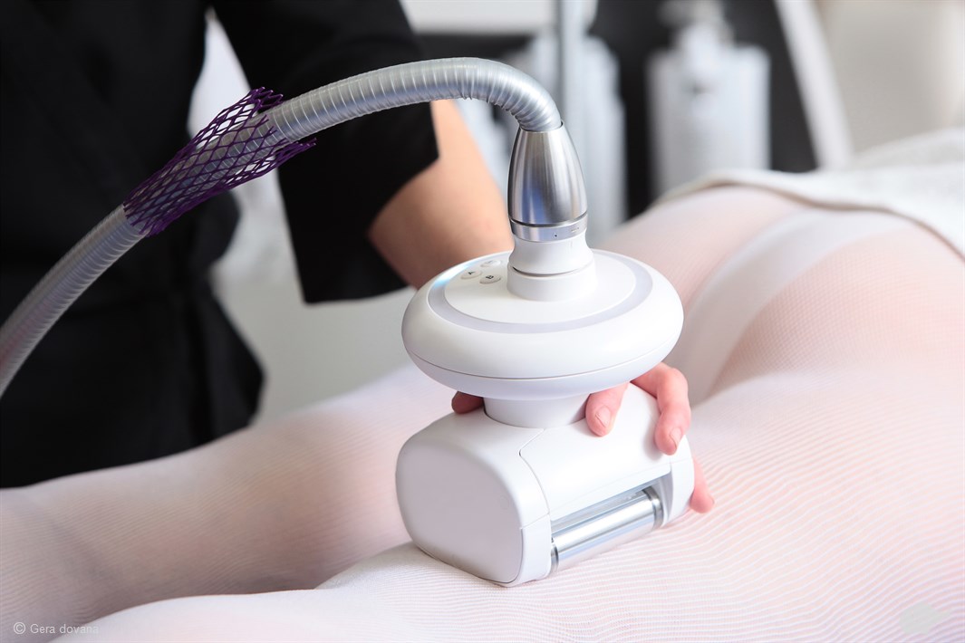 Endermologinis LPG masažas