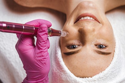 Regeneracinė egzosomų terapija su „Dermapen“