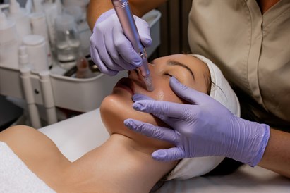 Veido procedūra su egzosomų koncentratu